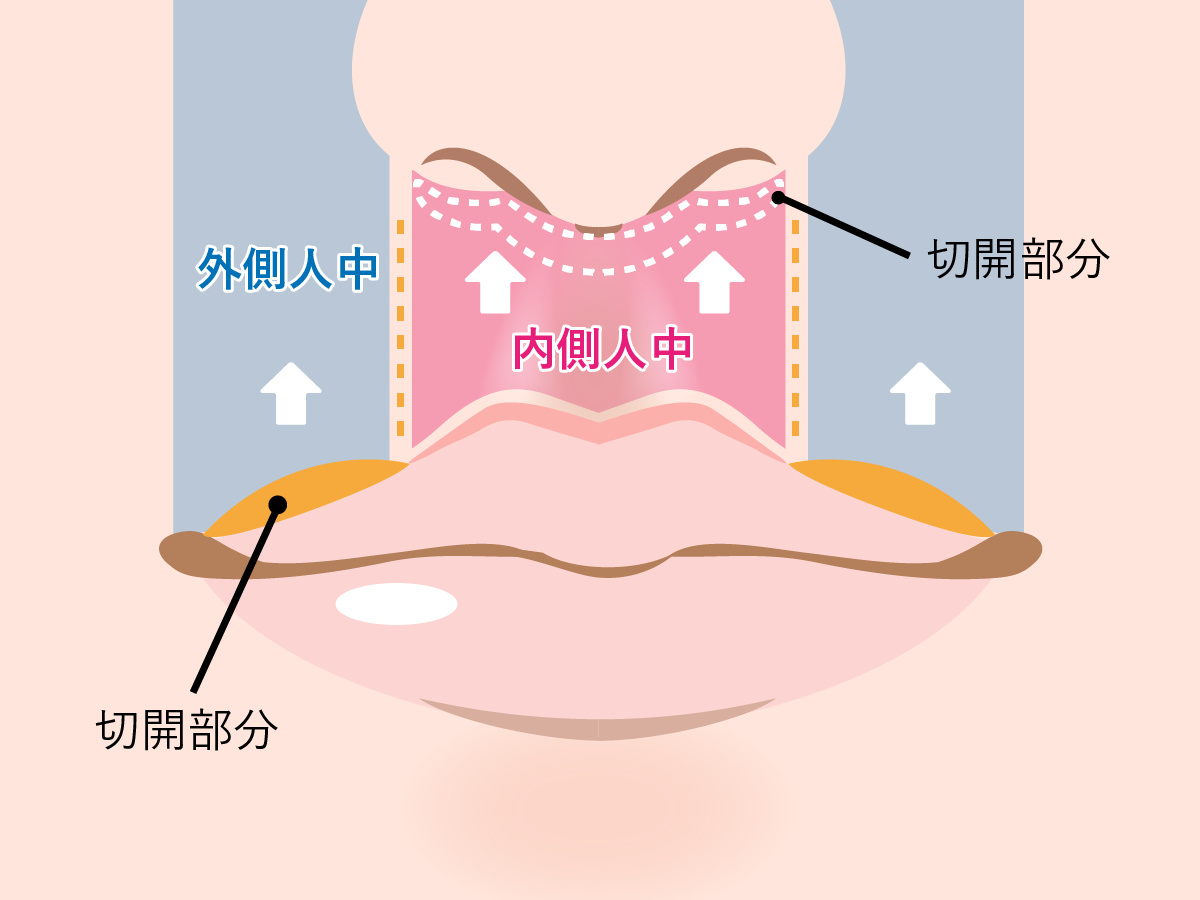 人中とはどこの部位？顔立ちを左右する黄金比と最新短縮術の全貌