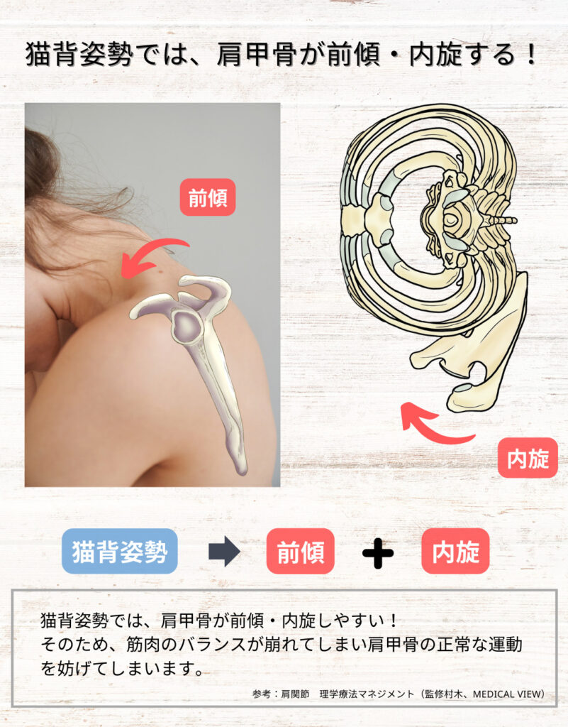 前鋸筋の作用と解剖学の全貌｜肩の痛みや翼状肩甲骨を防ぐ決定打
