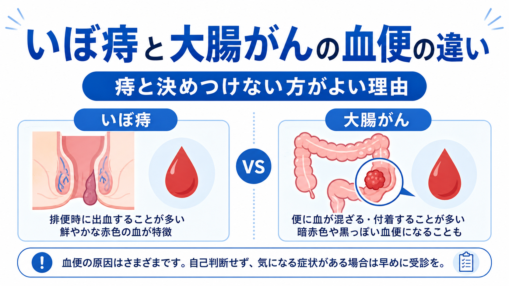 大腸がんと痔の違いは？血便の色と便の太さで見抜く危険な初期兆候