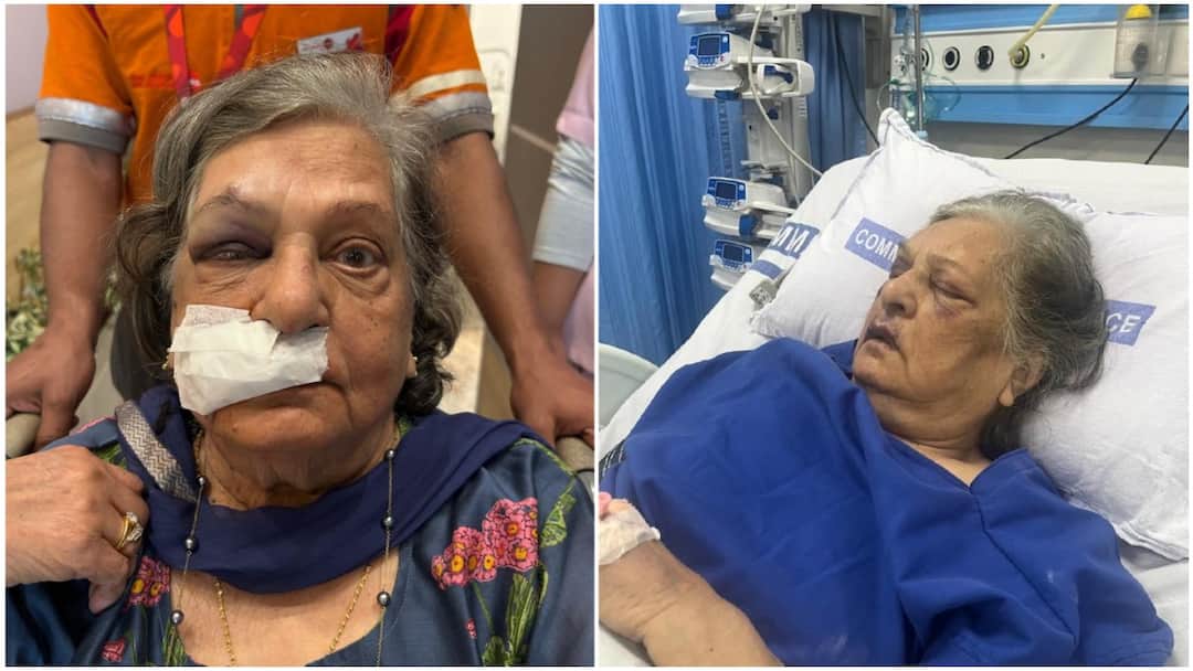 An 82-Year-Old Woman Is in Hospital with Life-Threatening Injuries