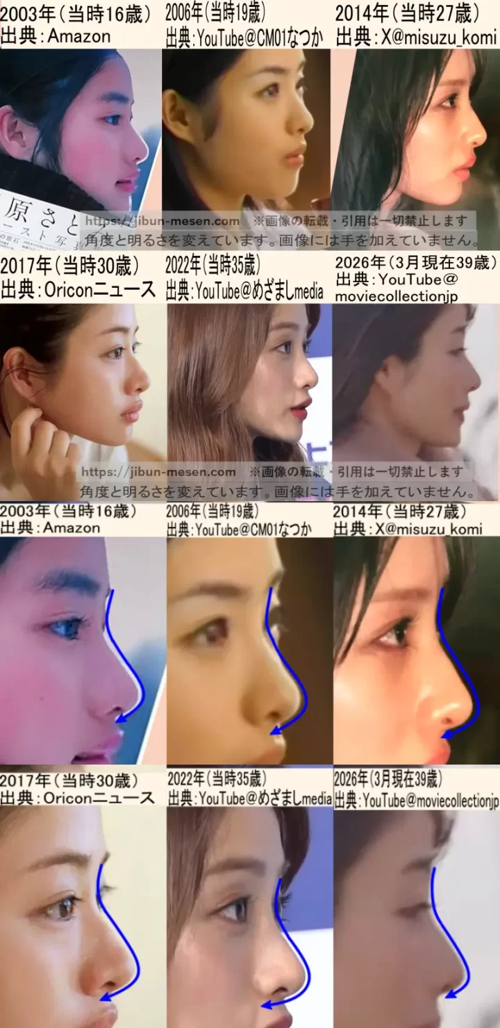 石原さとみの整形疑惑を徹底検証！昔と今の顔変化と垢抜けの全貌