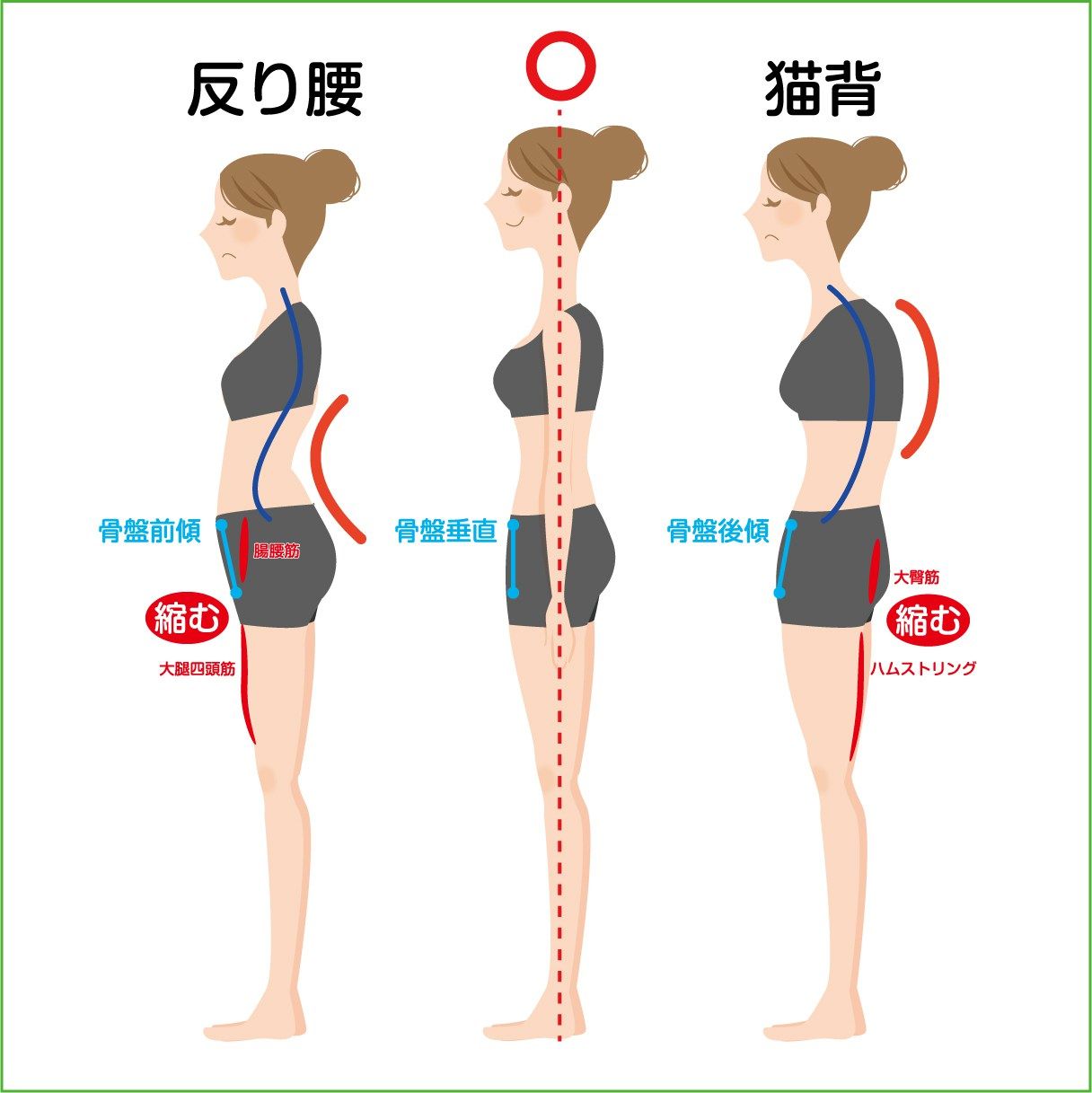 骨盤が立たない原因とは？座ると倒れる理由と劇的改善法を徹底解説