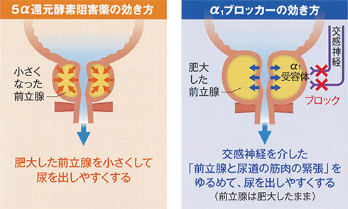 【徹底調査】 前立腺 が ん 予防 射精 2026年最新芸能速報 #723
