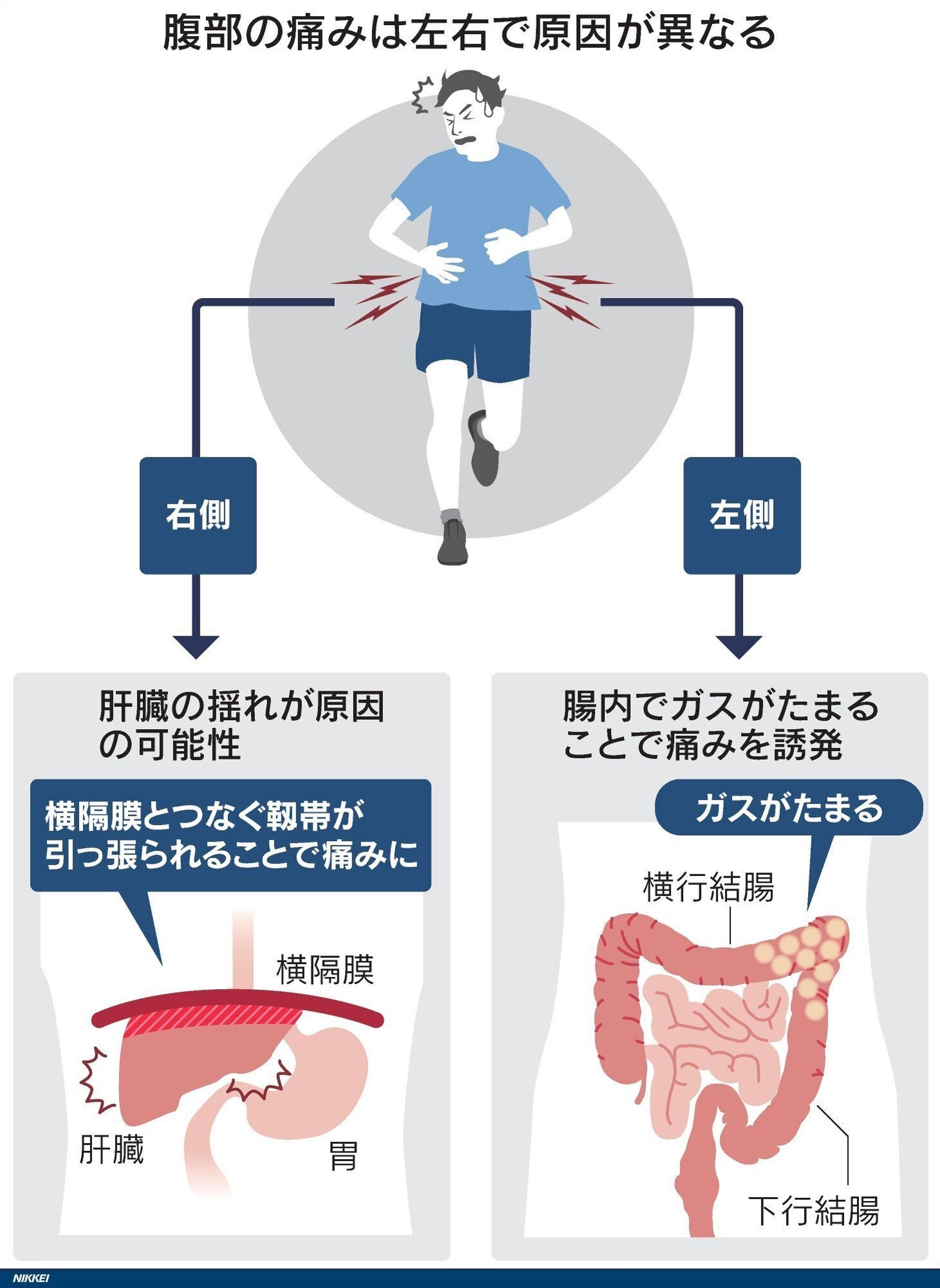ランニング中の腹痛を今すぐ止める！左右別の原因と即効対処法