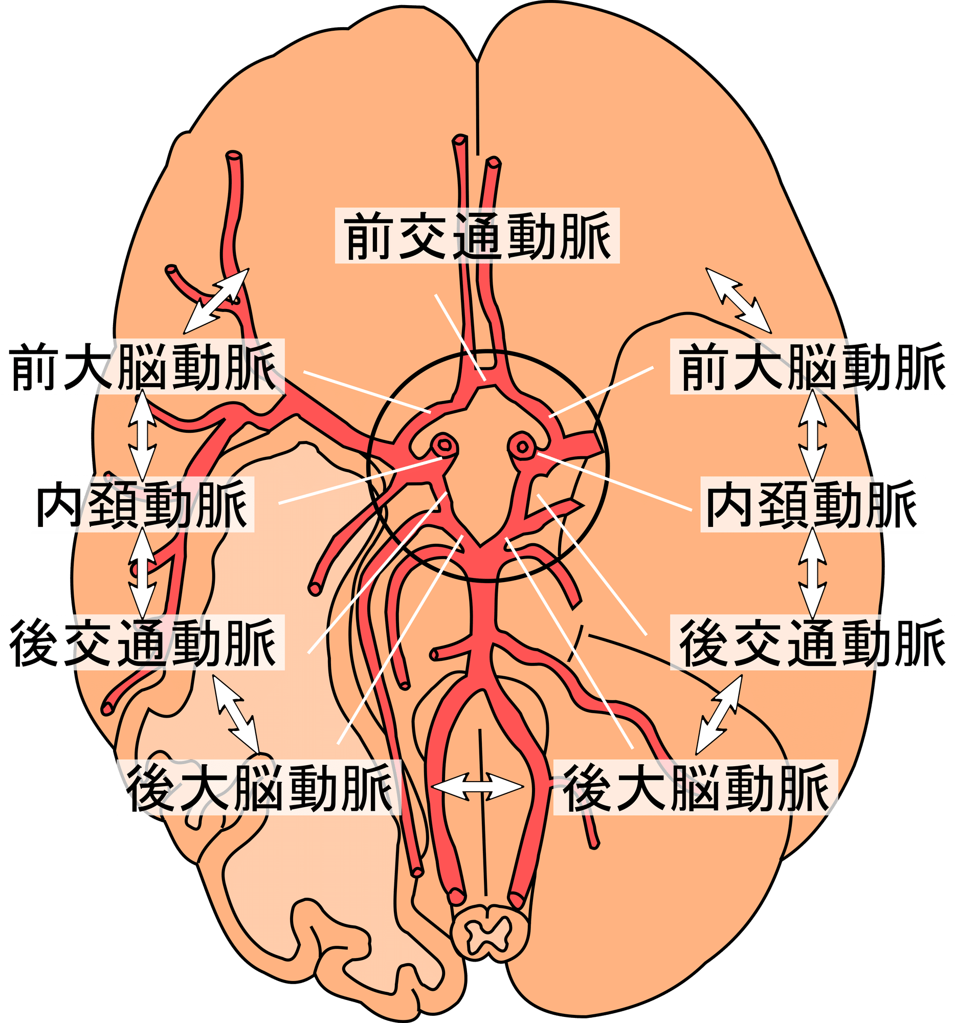 脳動脈瘤はなぜ多発する？ウィリス動脈輪の解剖と破格リスクを徹底解説