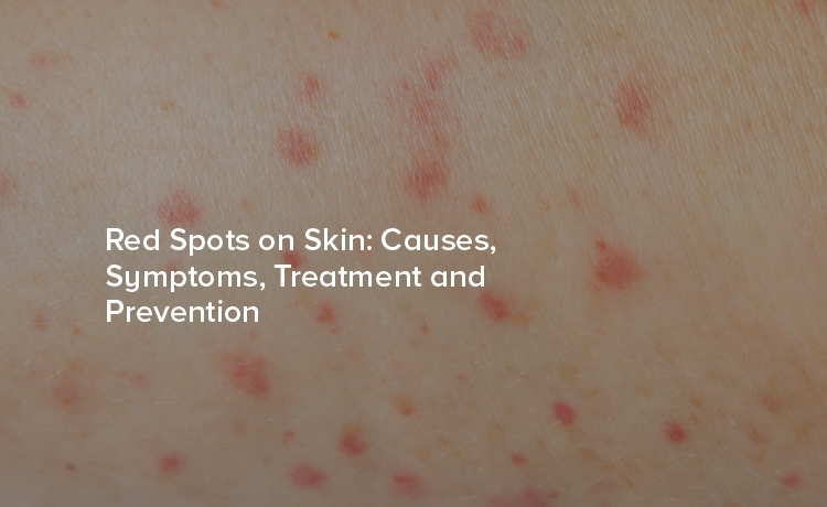 Tiny Red Spots on Skin Very Itchy