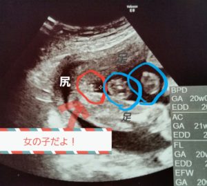 【熱愛】 妊娠 性別 女の子 特徴 2026年最新メディア #820