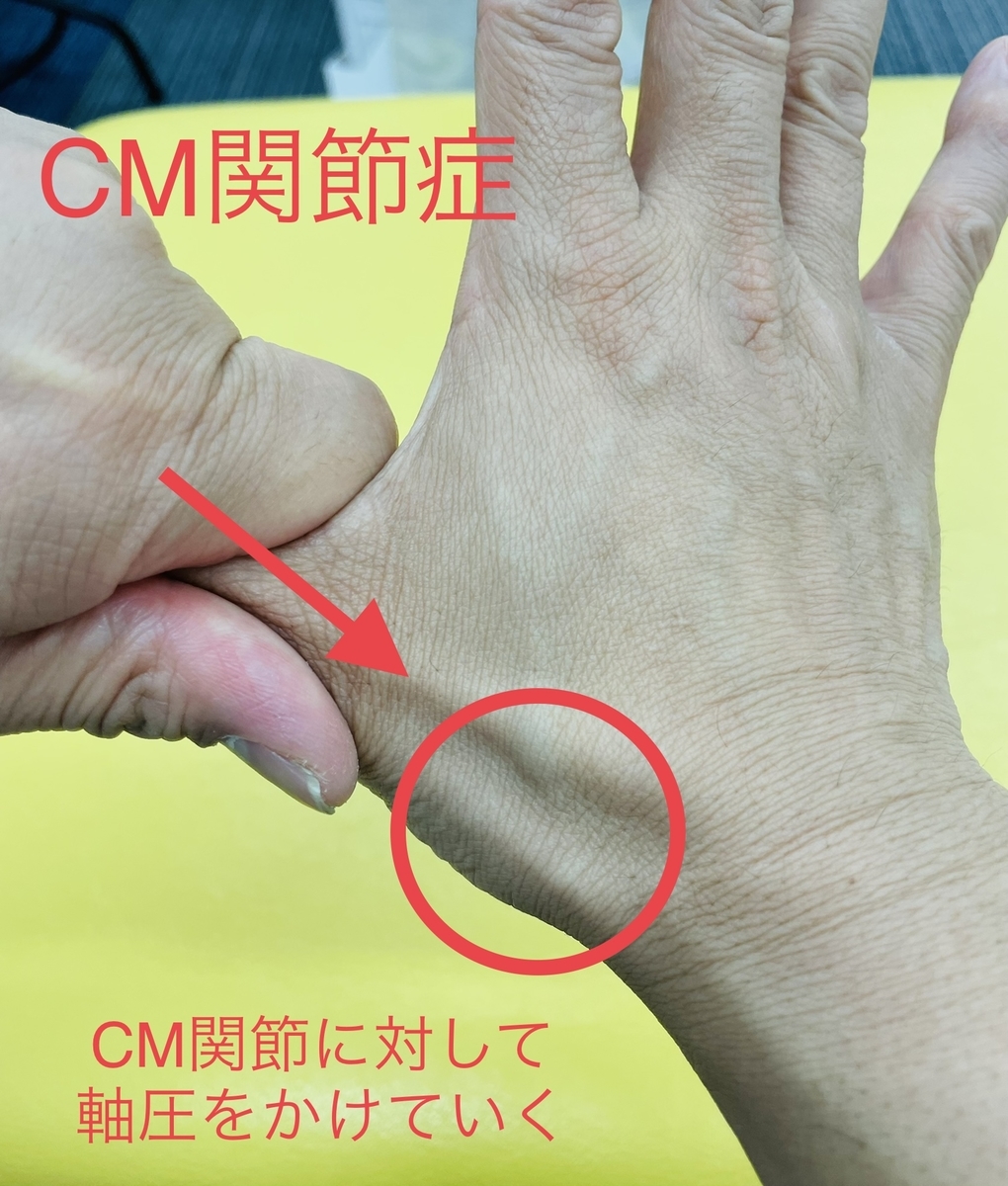 手の親指の付け根が痛い原因を徹底解明｜腱鞘炎と母指Cm関節症の最新治し方
