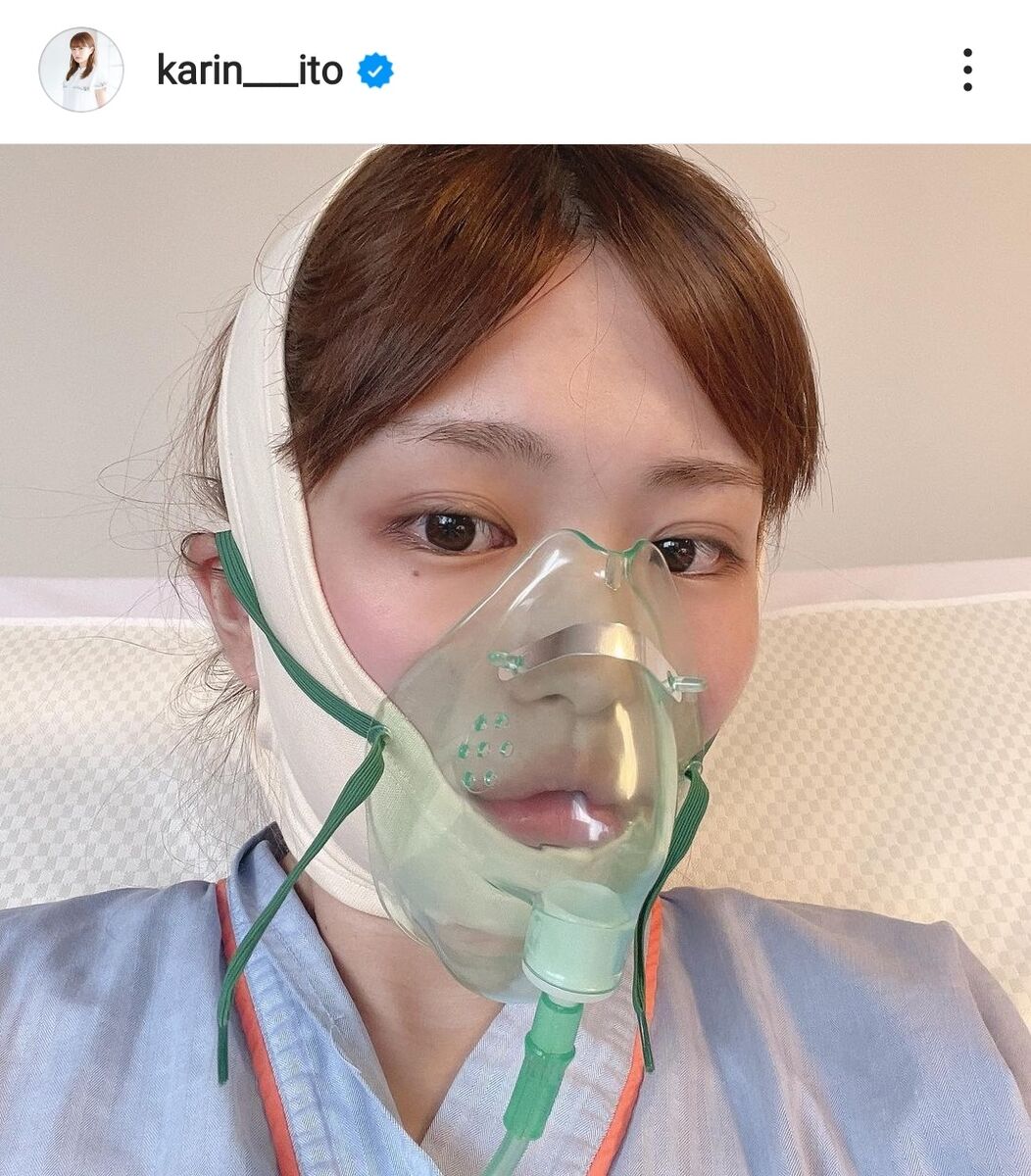 顎変形症の手術を公表した芸能人の劇的変化！保険適用と整形の真実