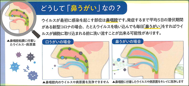 2026年春の健康トレンド：「鼻うがい」は本当に効くのか？医師が明かす驚きのメカニズムと正しい極意