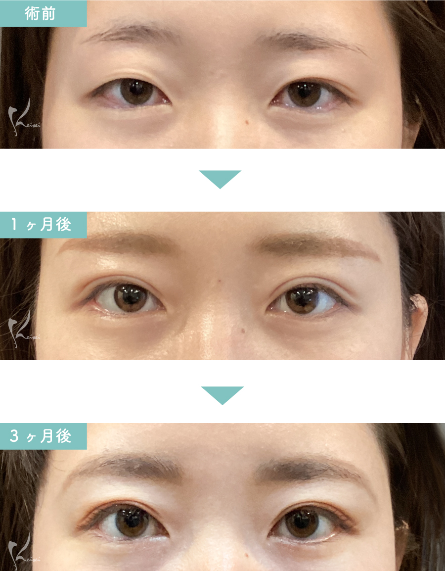 恵聖会クリニックの口コミ評判と失敗の噂を徹底解剖！二重や脱毛の実態