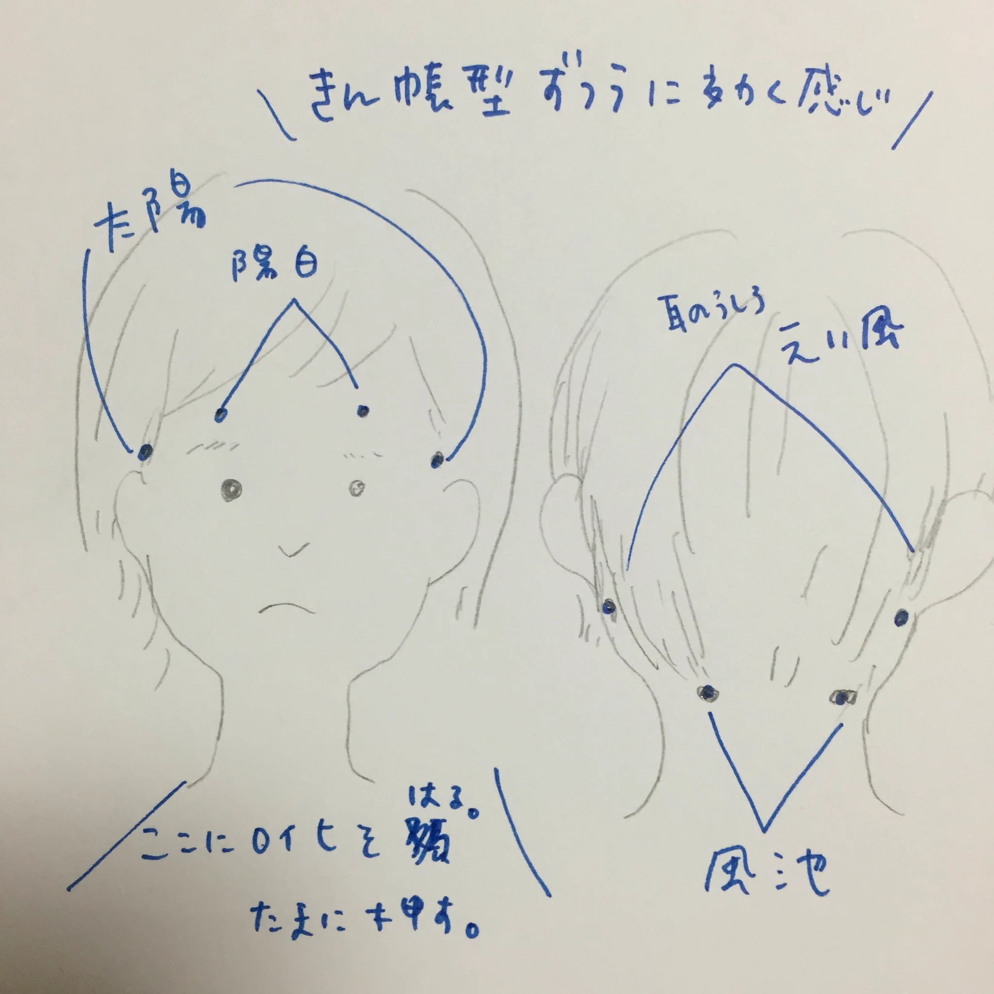 ロイヒつぼ膏をこめかみに貼る危険性とは？頭痛の噂と代用ツボ検証