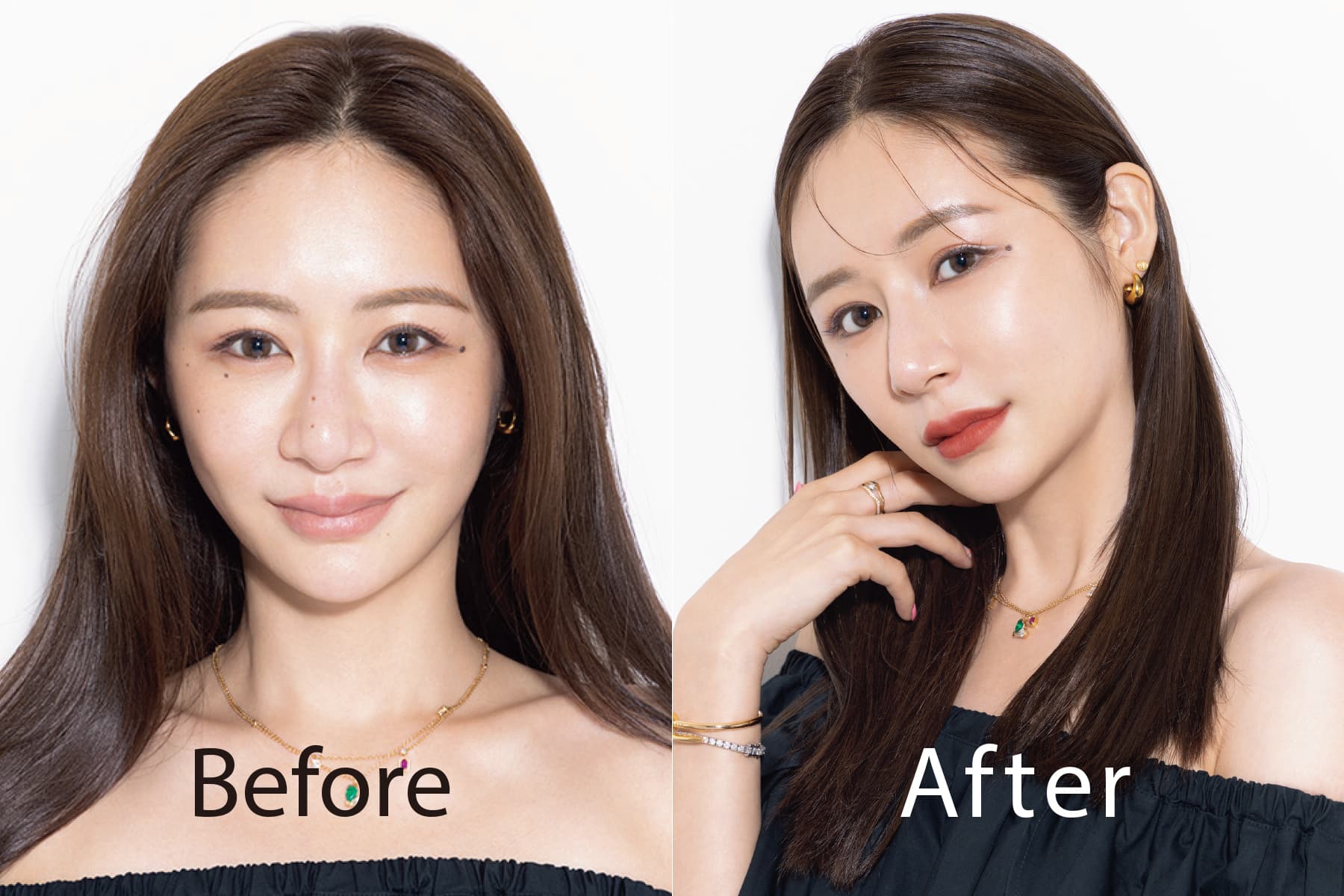 宮崎麗香の整形疑惑と公言した施術の真相！昔の写真と現在を徹底比較
