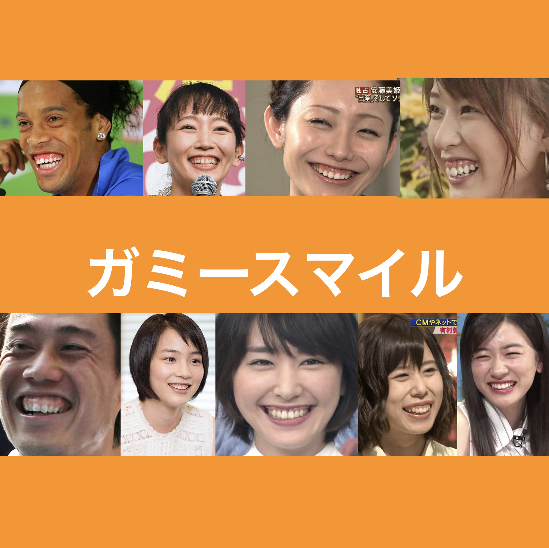 ガミースマイルの芸能人男女まとめ！治療の真相と愛される理由を徹底解説