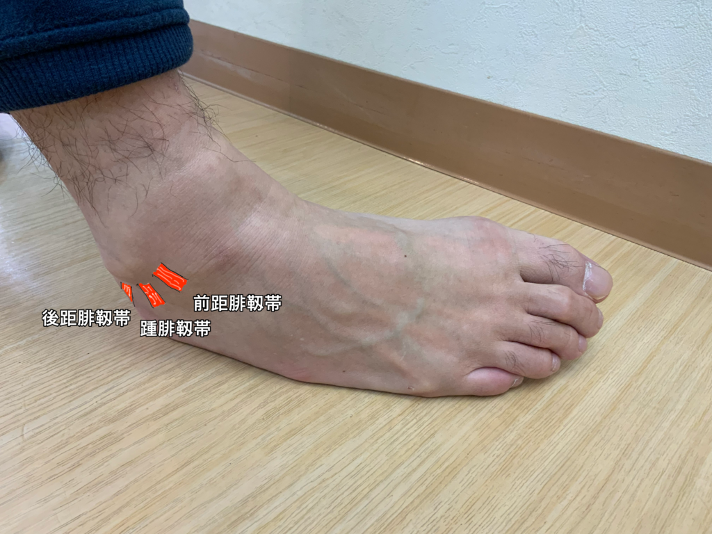 足のくるぶしの腫れ放置は危険？痛くない理由と病院の受診目安を解説