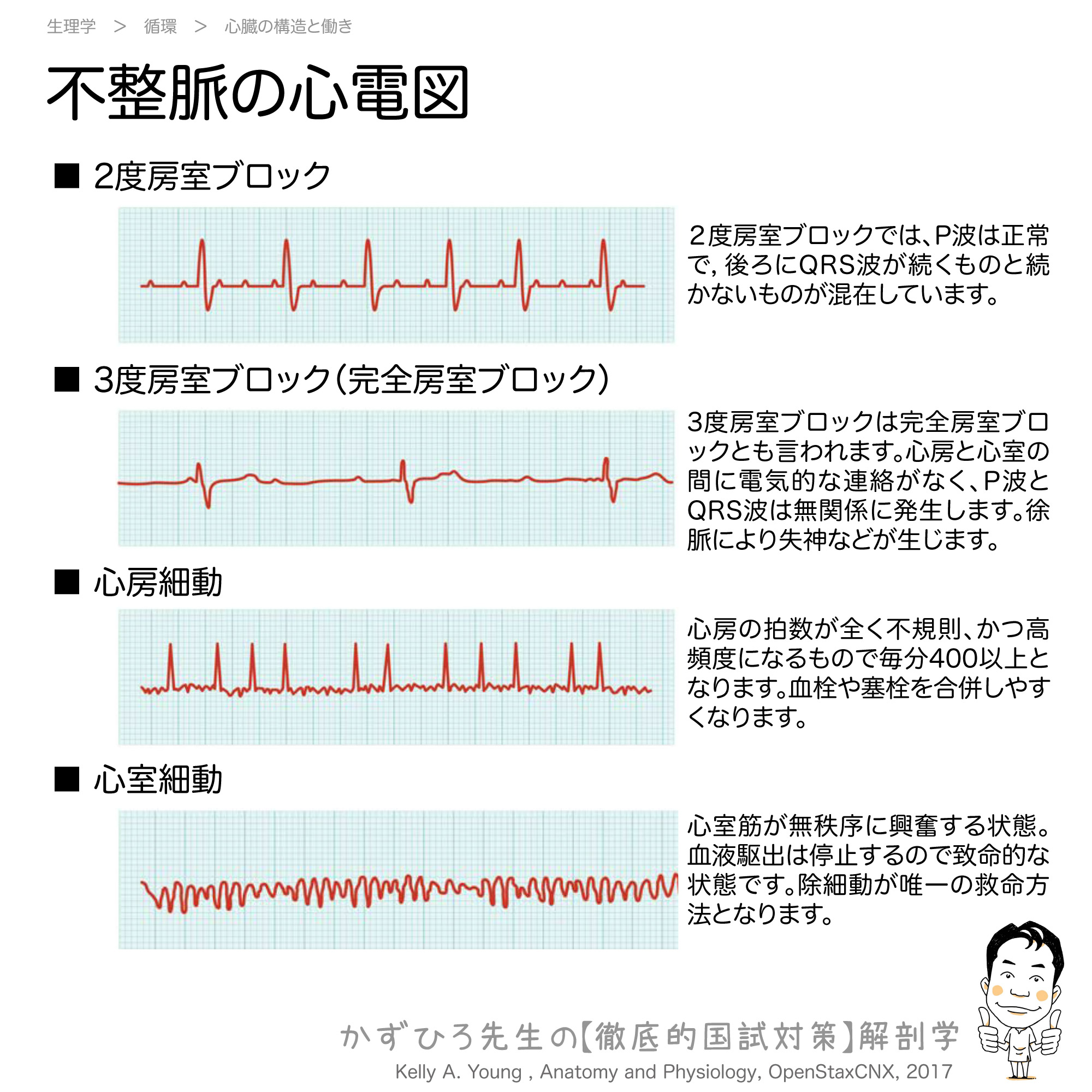房室ブロック心電図の危険サイン！1度・2度・3度の見分け方と緊急性