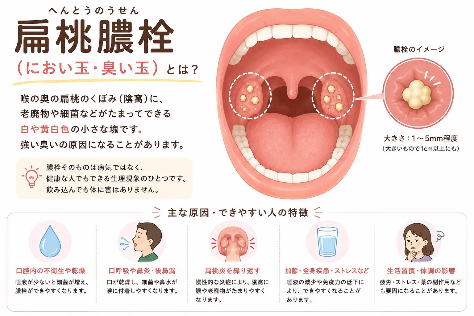 喉の奥の強烈な悪臭「匂い玉」の正体とは？危険な自力除去と正しい予防法
