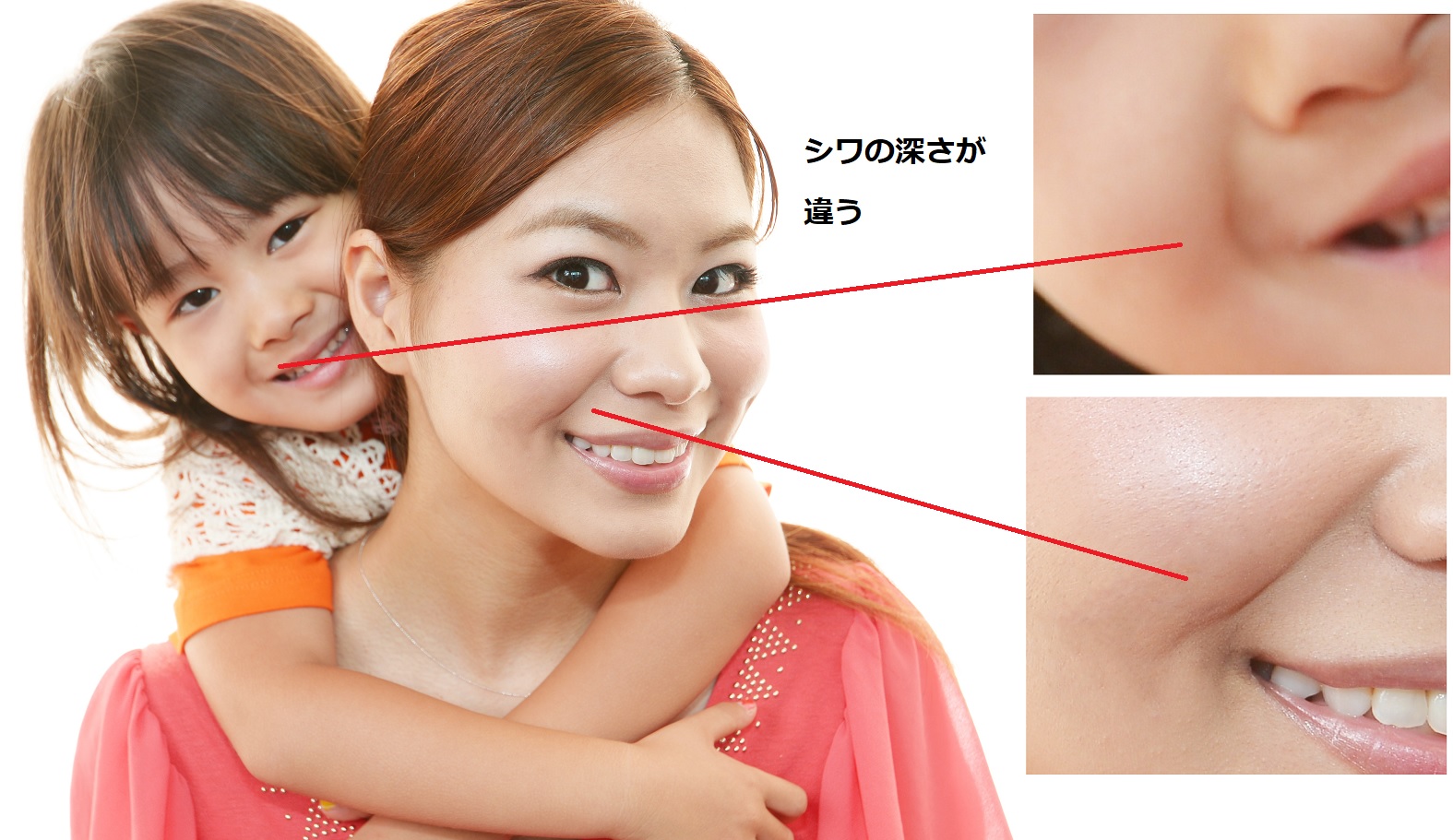 笑うと目立つほうれい線の原因は？若見えを取り戻す最新改善法を徹底解剖
