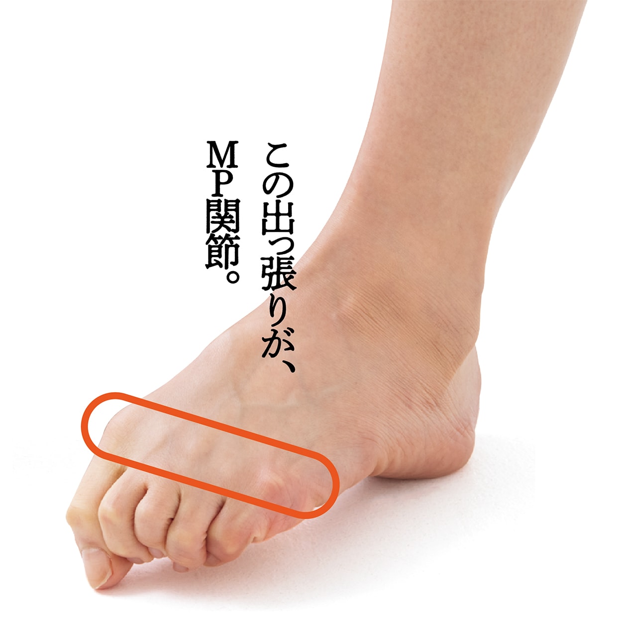 足の横アーチを復活させる方法！足裏のタコと開張足を治す決定版