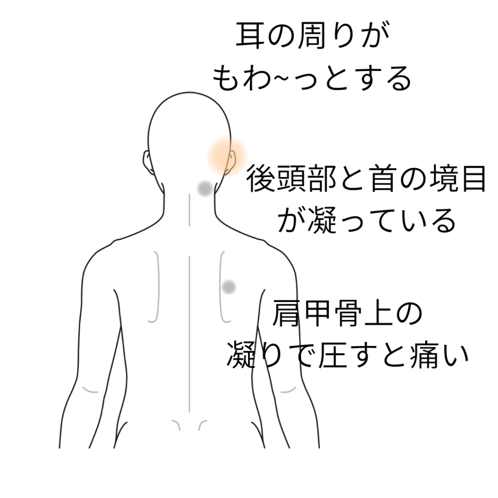 耳が痛いのは肩こりのせい？知るべき隠れた原因と正しい受診科