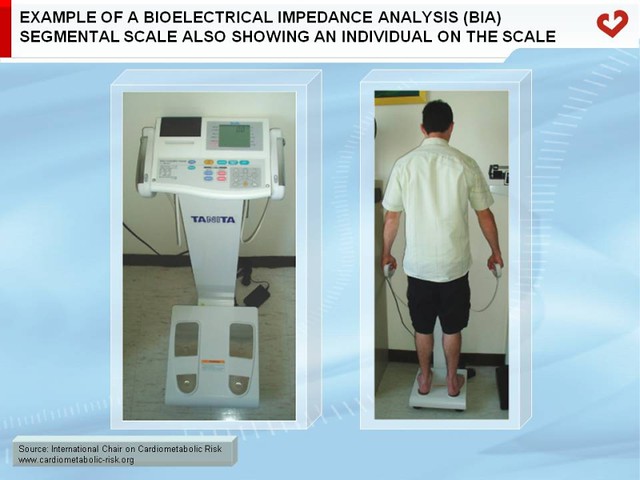 Define Bioelectrical Impedance Analysis