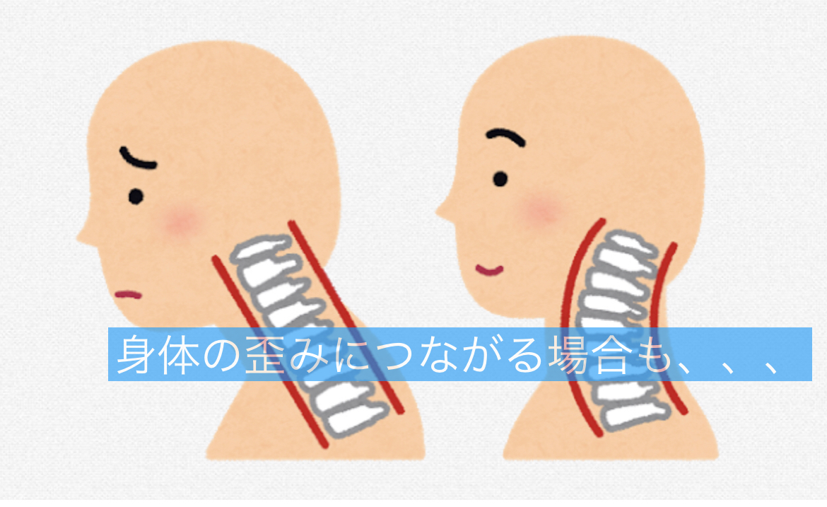 首を鳴らす癖に潜む脳梗塞の影！パキッ音の危険性と正しい治し方
