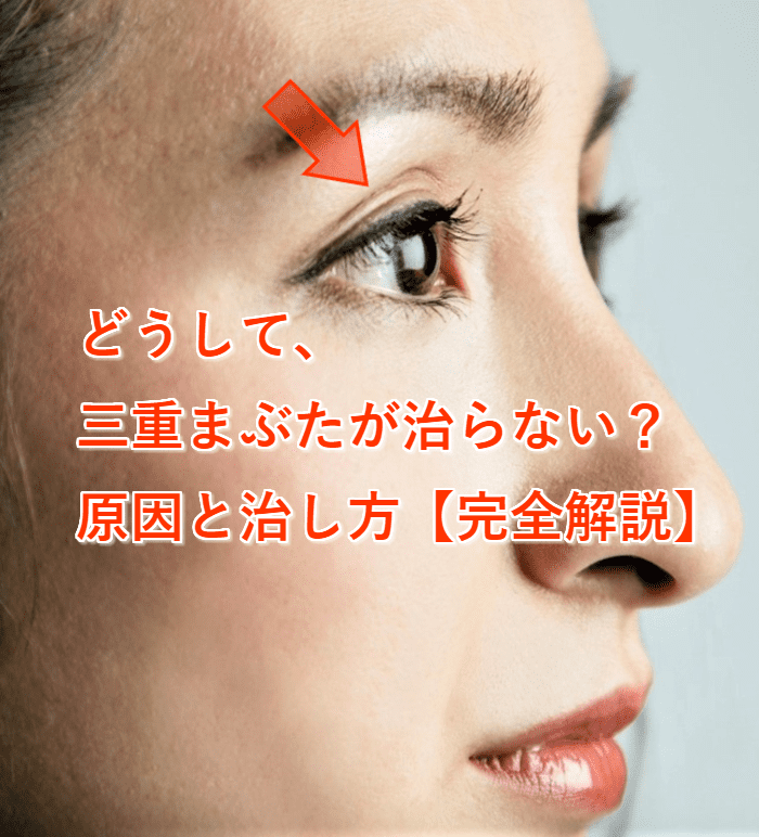片目だけ三重まぶたが治らない原因とは？自力で即効戻す対処法を徹底解説