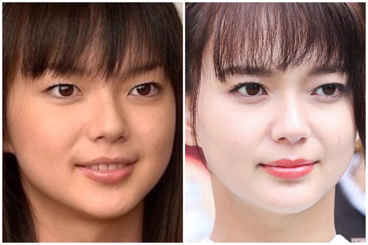 多部未華子の整形疑惑を徹底検証｜顔の変化の真相と2026年最新情報