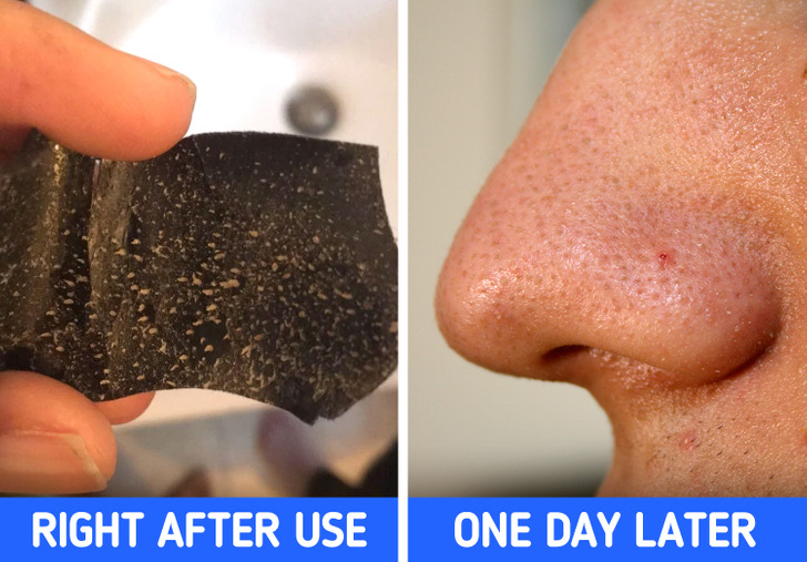 What to Do After a Pore Strip