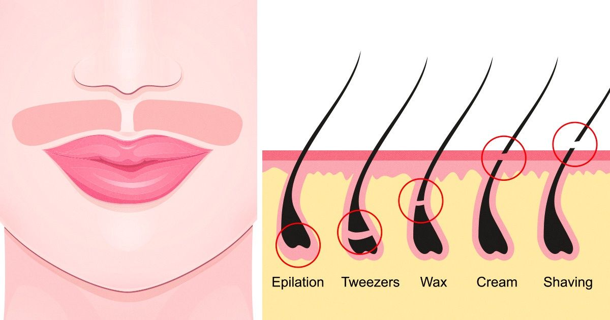 How to Rid of Chin Hair