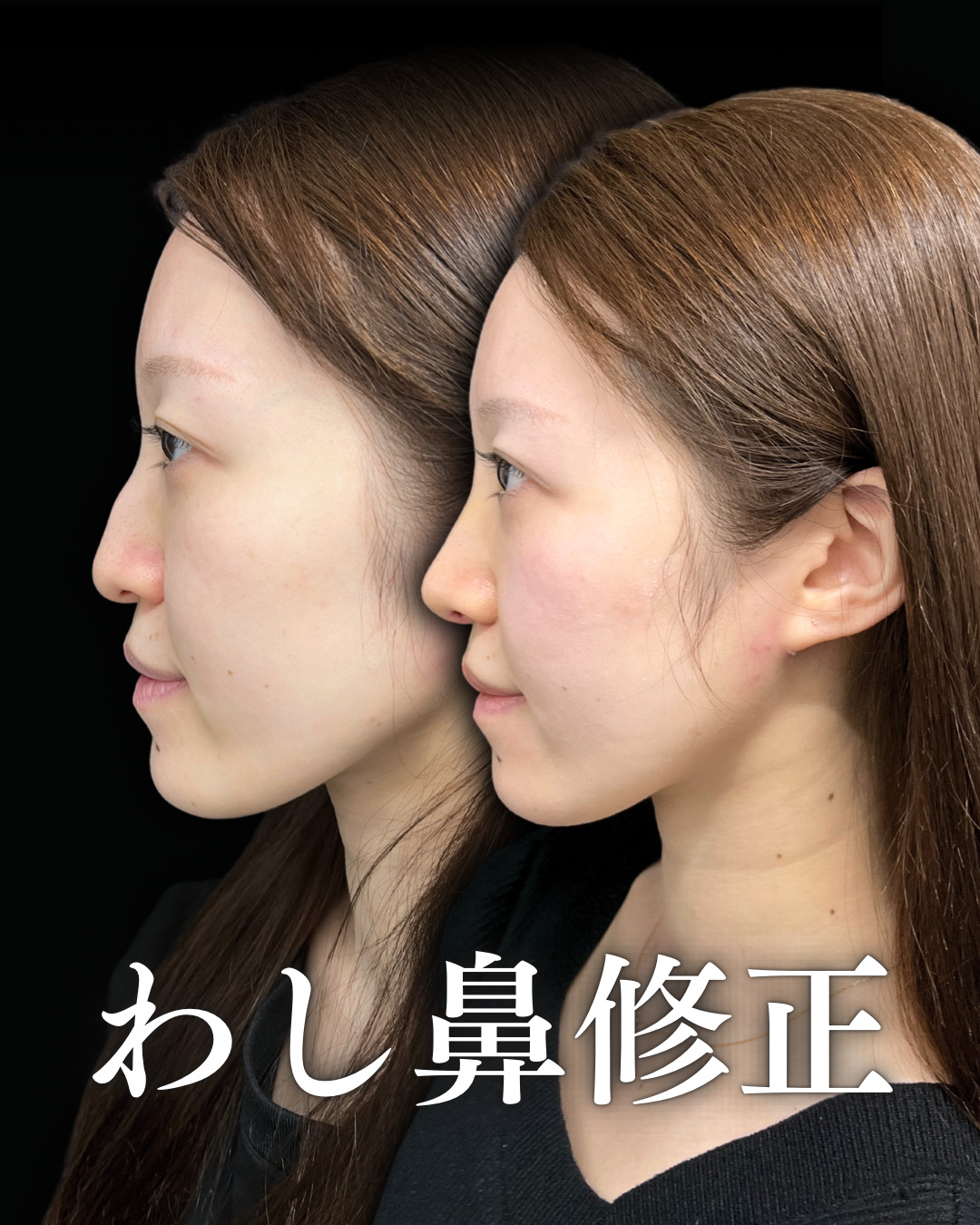 【2026最新】鷲鼻の女性が美人に映る理由｜横顔Eラインと垢抜け術
