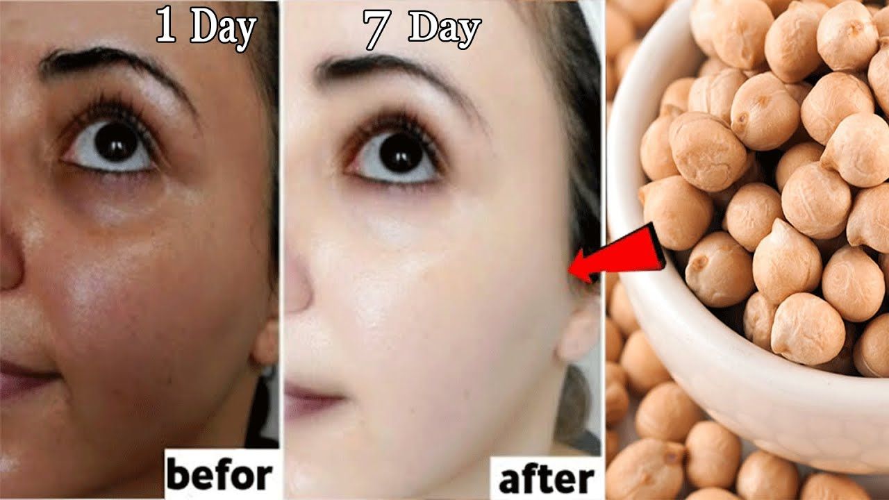 Chickpeas Benefits for Skin