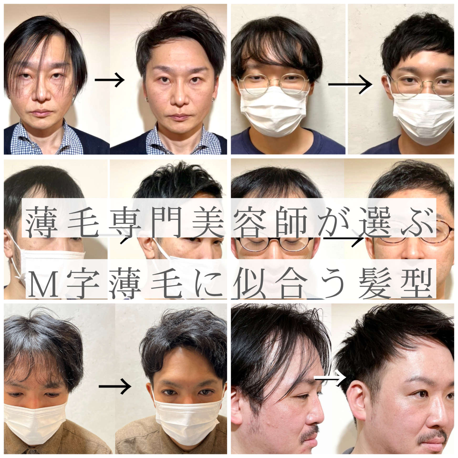 なぜ隠すと目立つ？薄毛でもかっこいいおっさん髪型の決定版2026