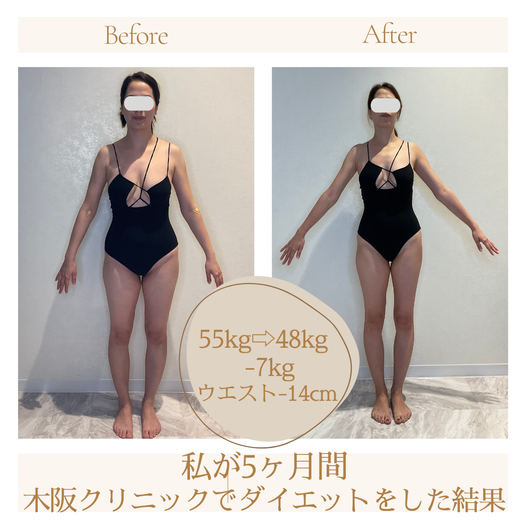 木坂クリニックの評判と予約攻略法｜内科・整形外科から混雑状況まで