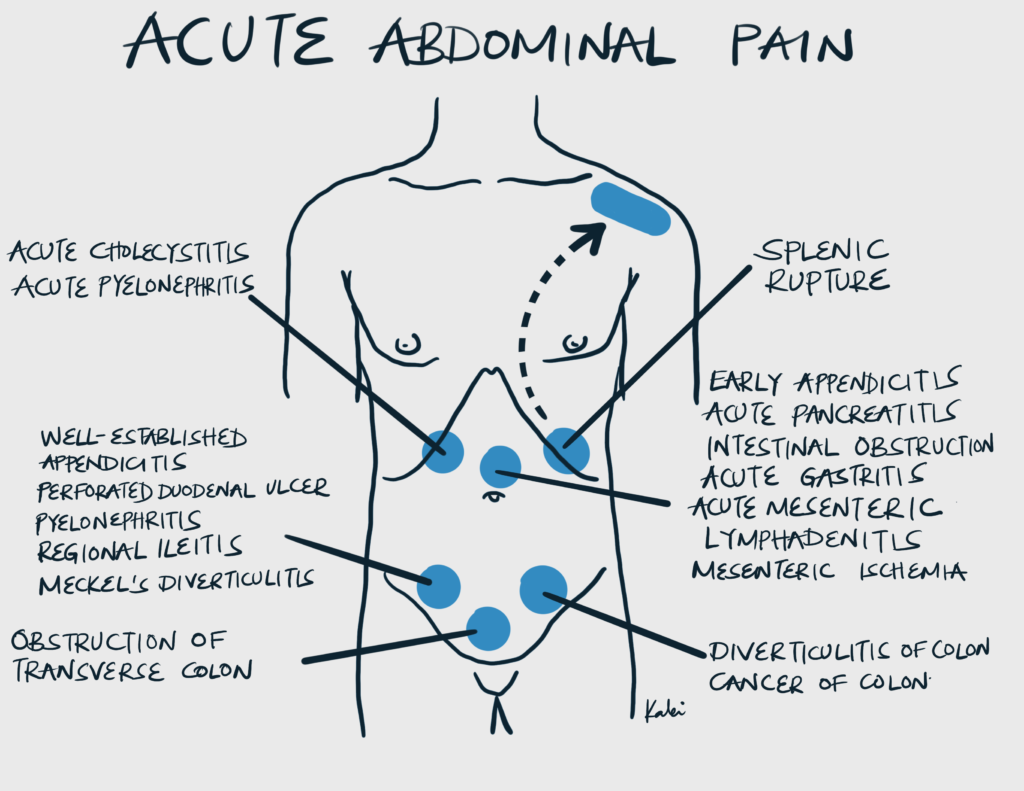 Bottom Right Stomach Pain
