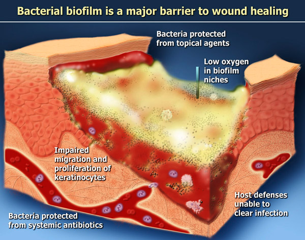 What Does White Skin Around a Wound Mean