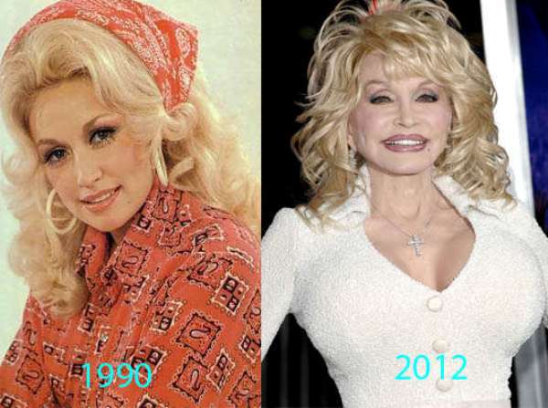 Between 1992 and 2004: the Timeline of Dolly's Breast Procedures