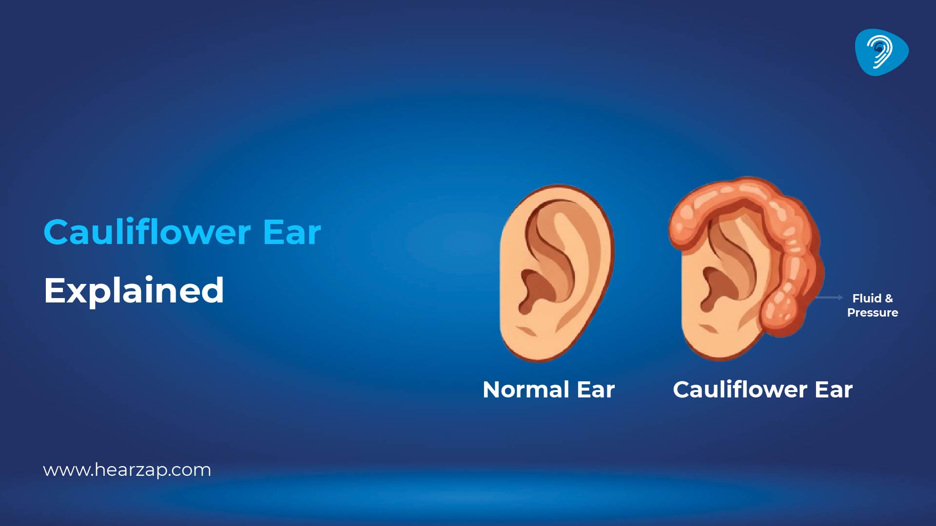 Why Do People Want Cauliflower Ear