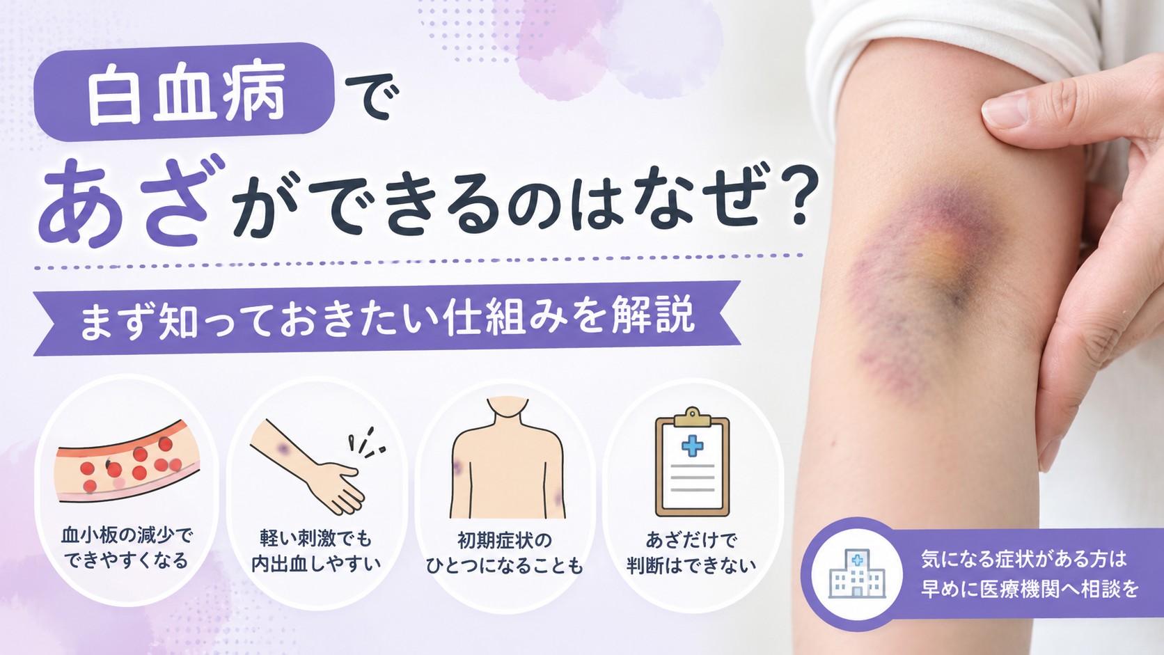身に覚えのないあざは白血病の兆候？打撲との違いと危険な見分け方