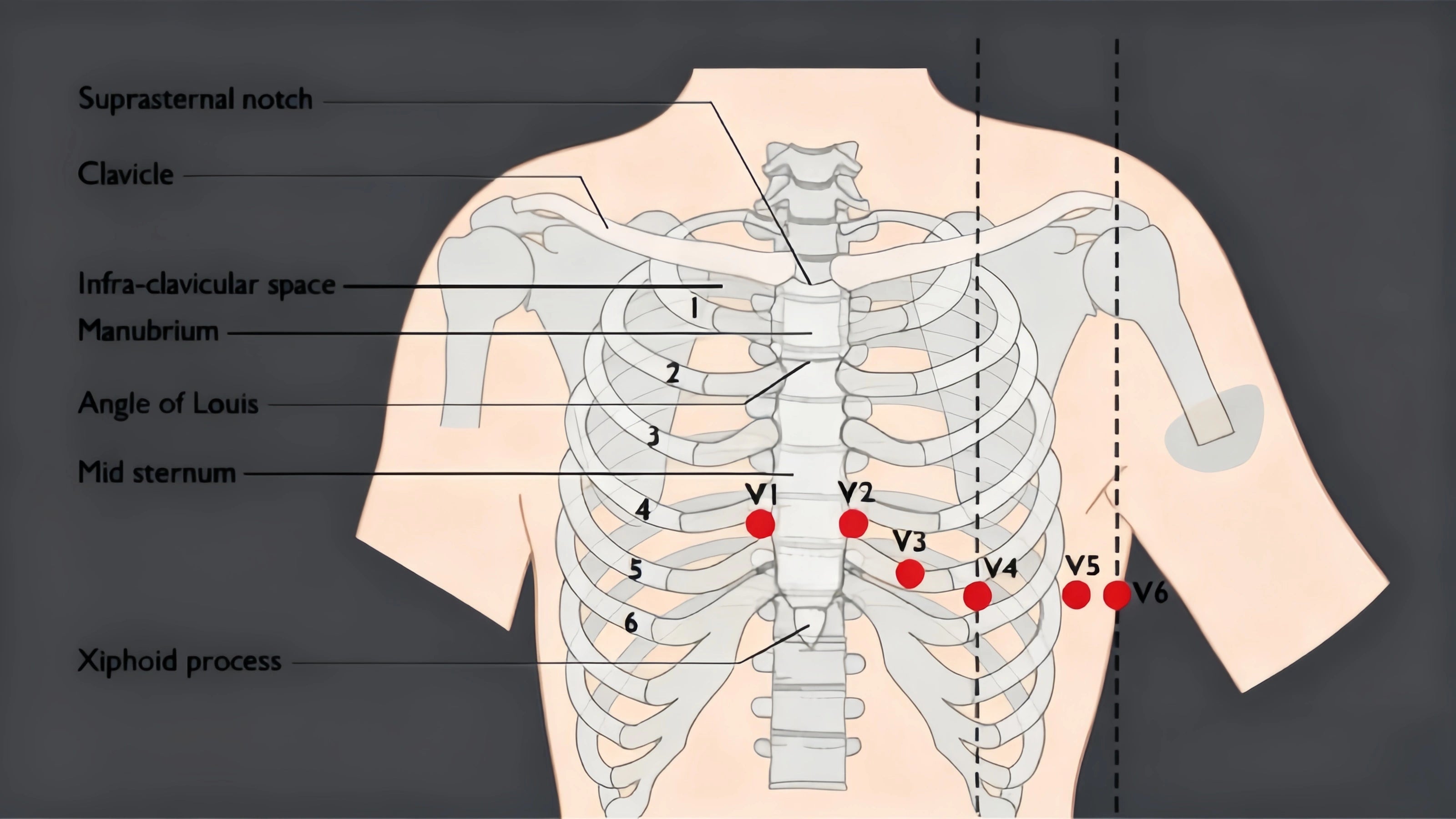 What Is the Main Reason for Obtaining a 12-Lead Ecg