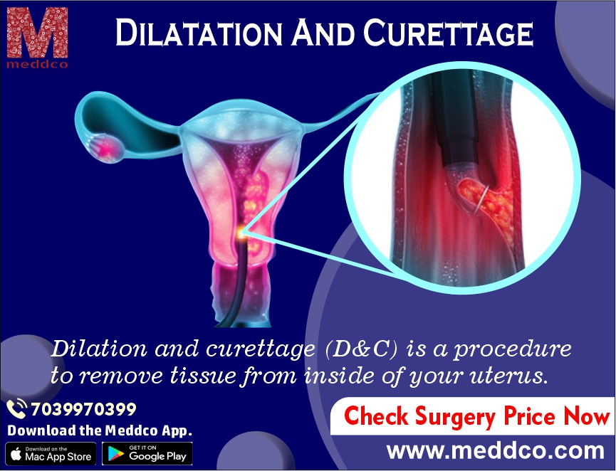 D & C Procedure