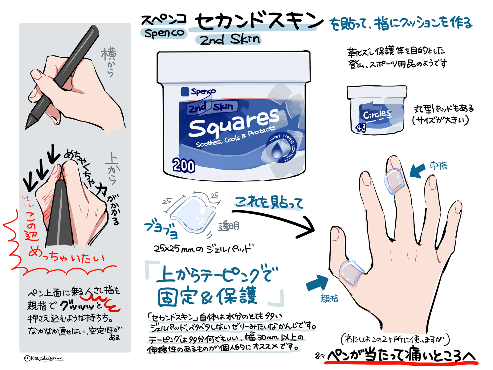 ペンだこの治し方決定版｜無理に削らず綺麗に治すセルフケアと予防