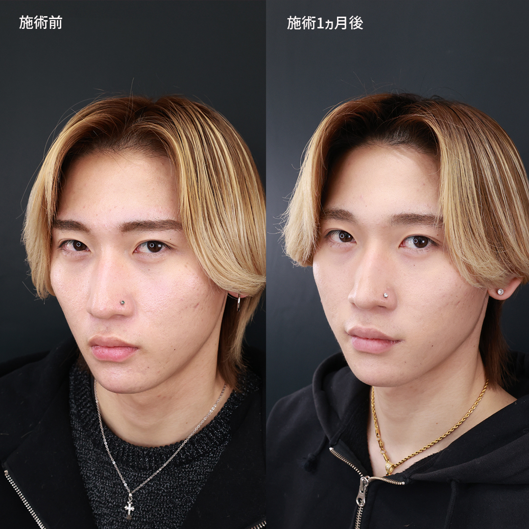 口角が上がっている人はなぜ魅力的？人相学と深層心理が明かす幸運の真相
