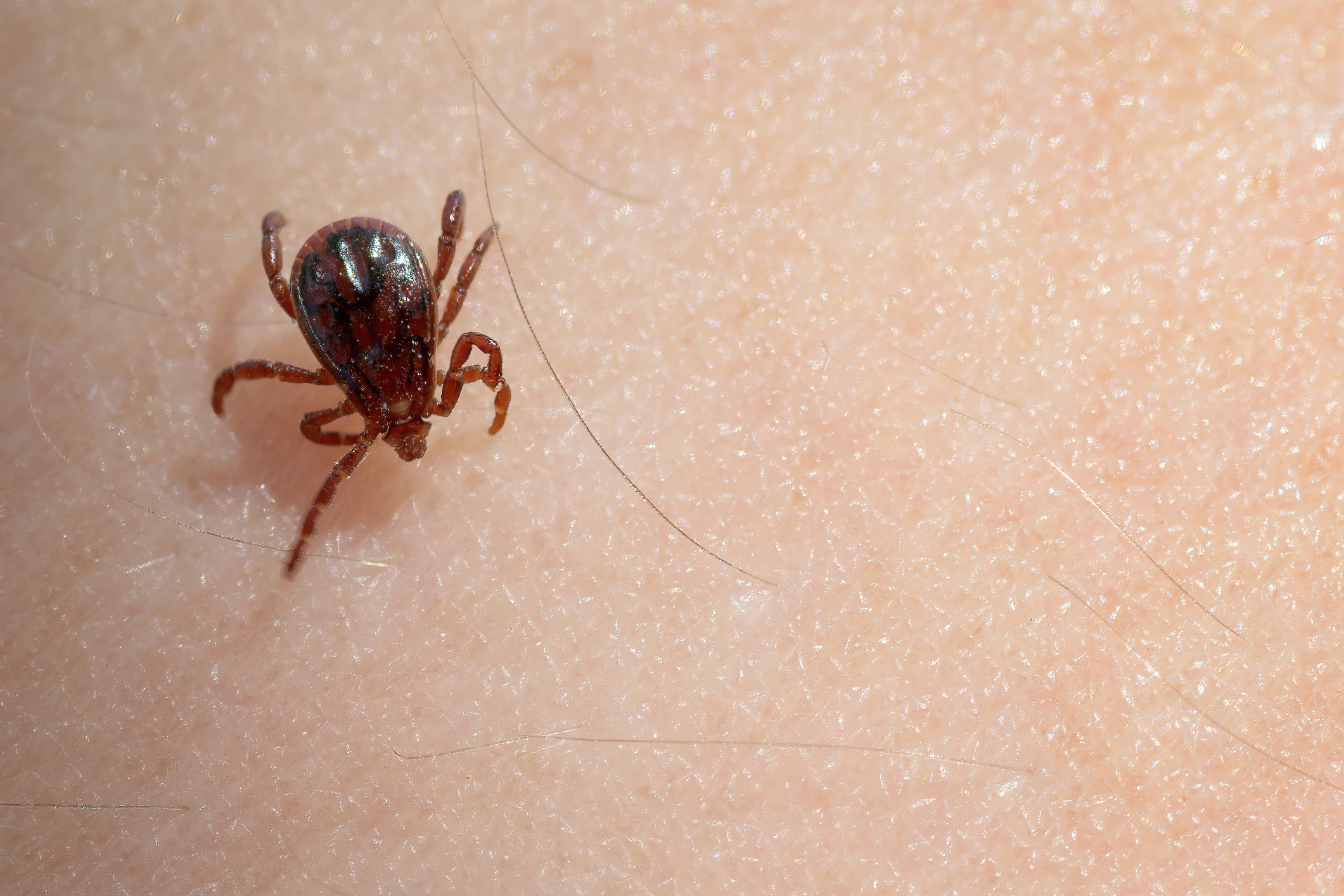 Can Dog Ticks Go on Humans