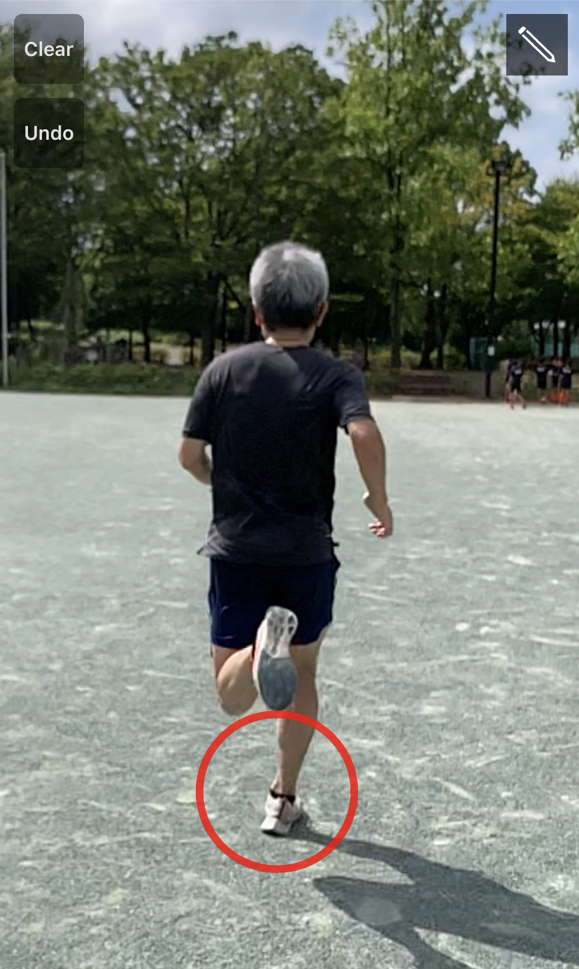 足の甲が痛いランニングの真実！靴紐の圧迫か疲労骨折か見分け方解説