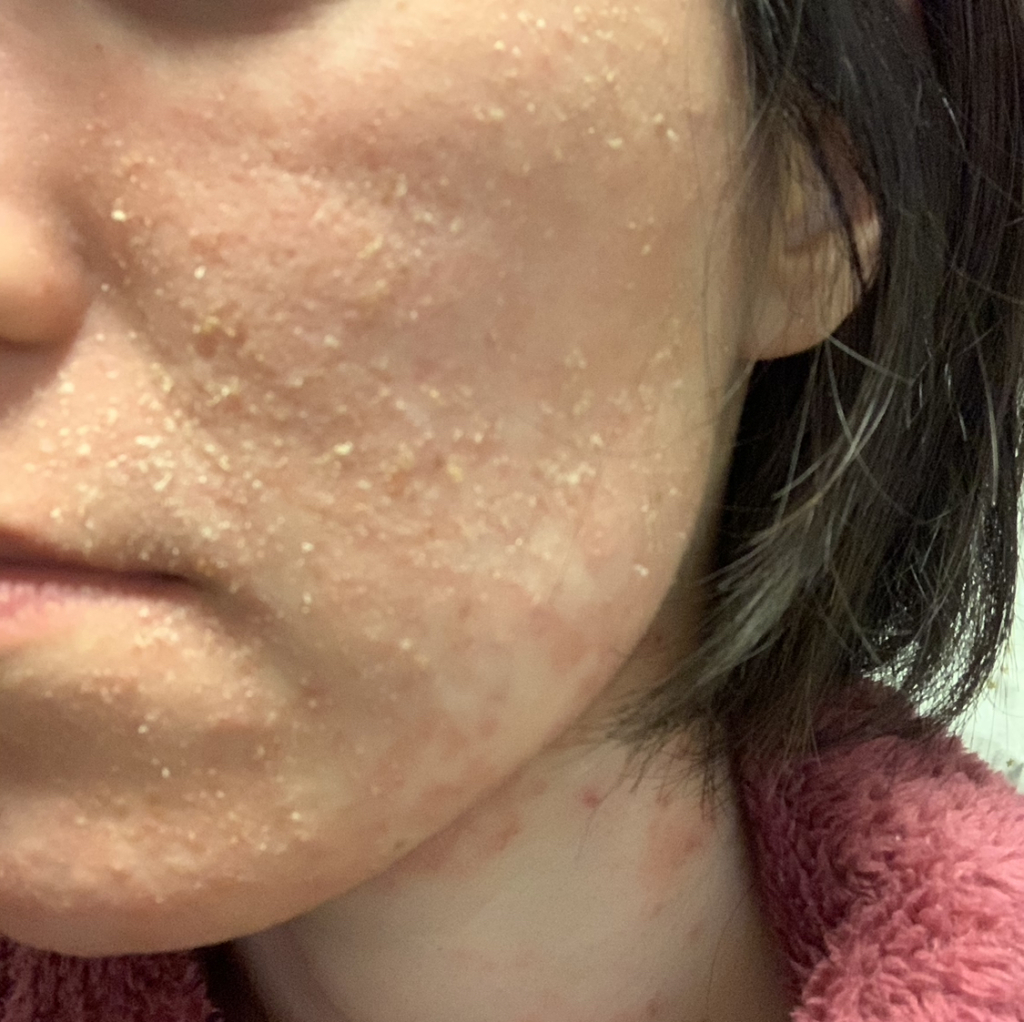 肌断食とは？宇津木式のやり方や効果・失敗しない秘訣を徹底解説