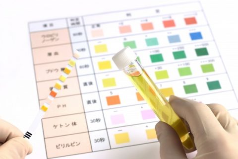 【速報】 尿 検査 生理 中 最新情報まとめ 2026 #943