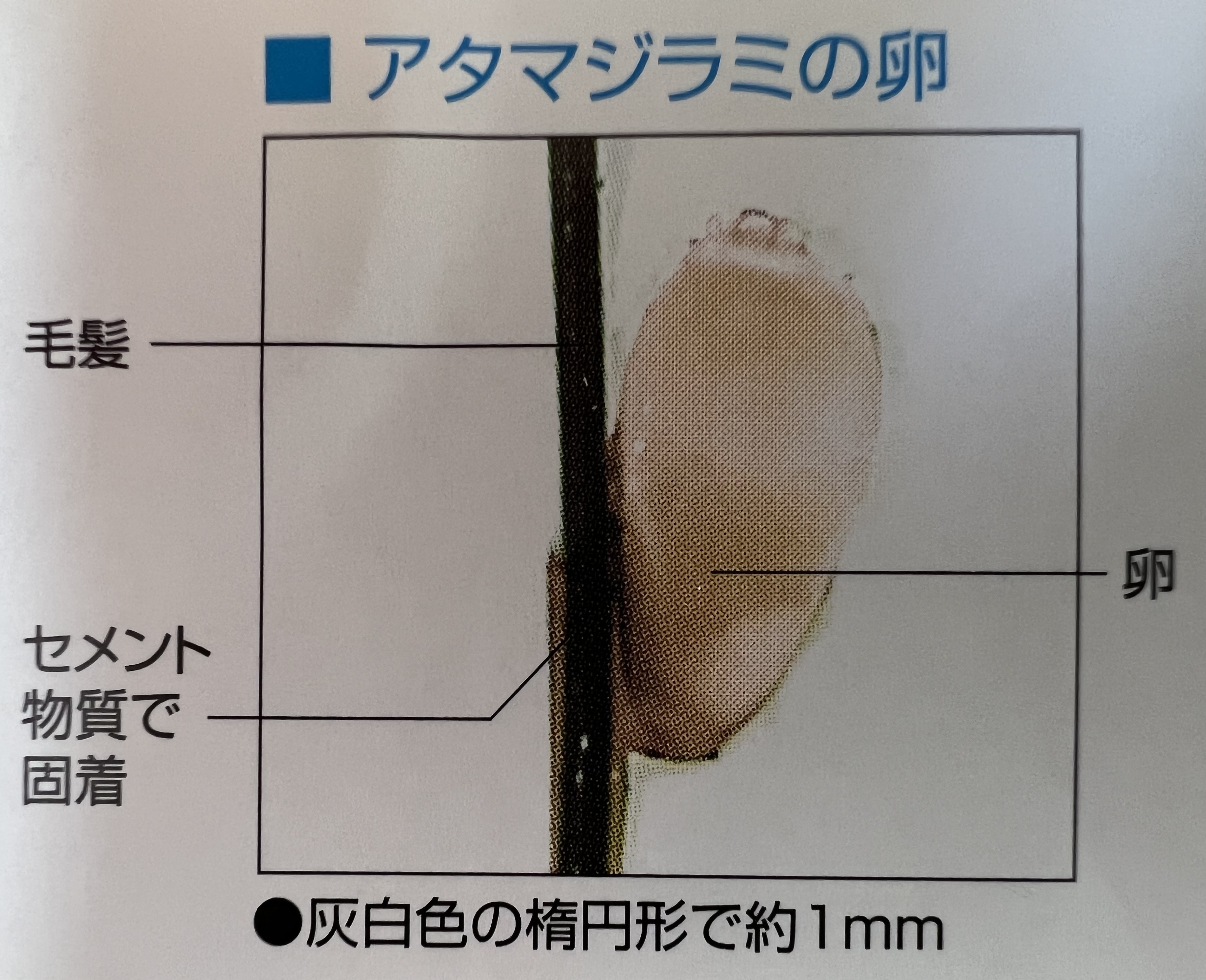 シラミの卵とフケの決定的な違い！白い粒の正体と最短駆除完全版