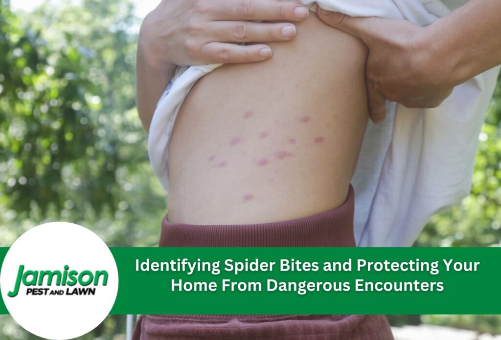 Epsom Salt and Spider Bites