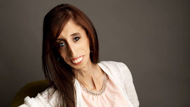 Images of the Ugliest Woman in the World